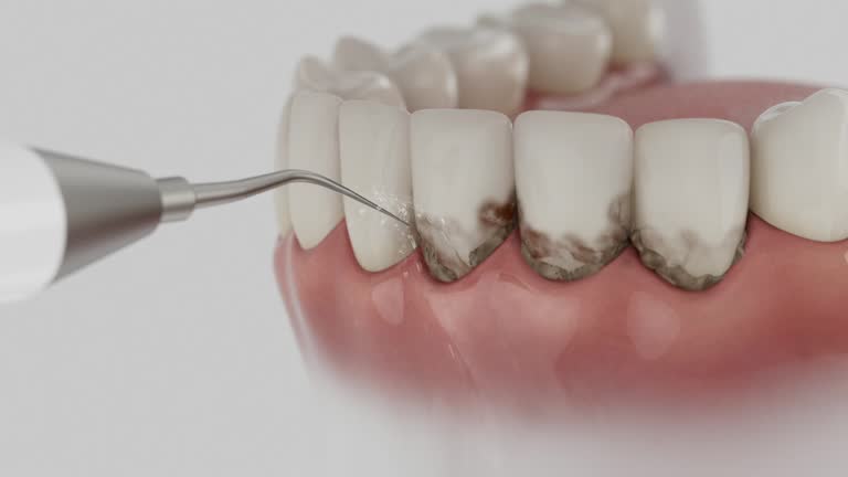 Trusted Teeth Cleaning And Checkup service in Cedar Bluff, VA - Dentist Open Now